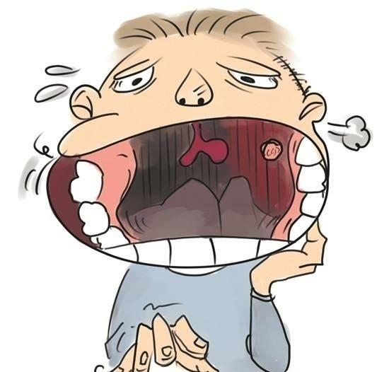 肿瘤医师黄俊:槟榔是口腔癌比较大的罪魁祸首