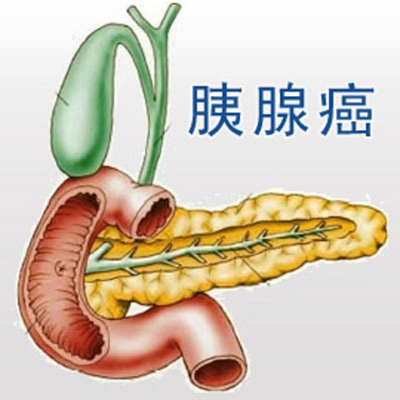 胰腺瘤生存率低且治疗困难?别怕,老中医张忠民有妙招!
