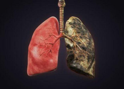 控制吸烟多吃蔬果可预防肺癌,广州御和堂中医小贴士