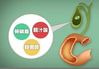 广州中医肿瘤医师排名|这些症状很有可能是胆管癌在"作祟"