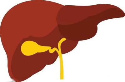 广州治疗胆管癌老中医:你了解胆管癌的症状表现和特征吗