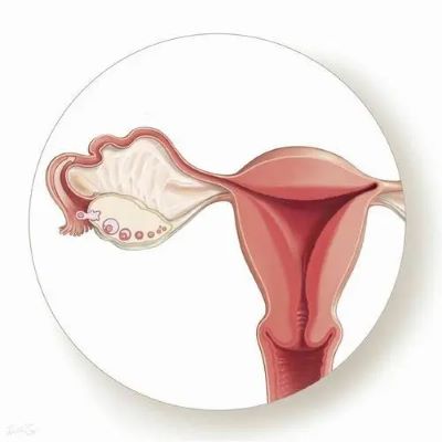为什么很多卵巢癌确诊后就是晚期?及时认清症状早做治疗很重要