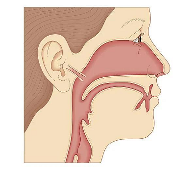 早期鼻咽癌的症状是什么?广州肿瘤老中医是这样回答的