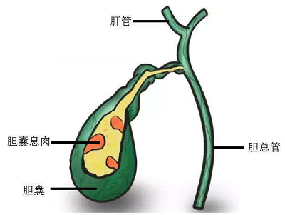 广州市治疗胆囊癌效果好的肿瘤医馆