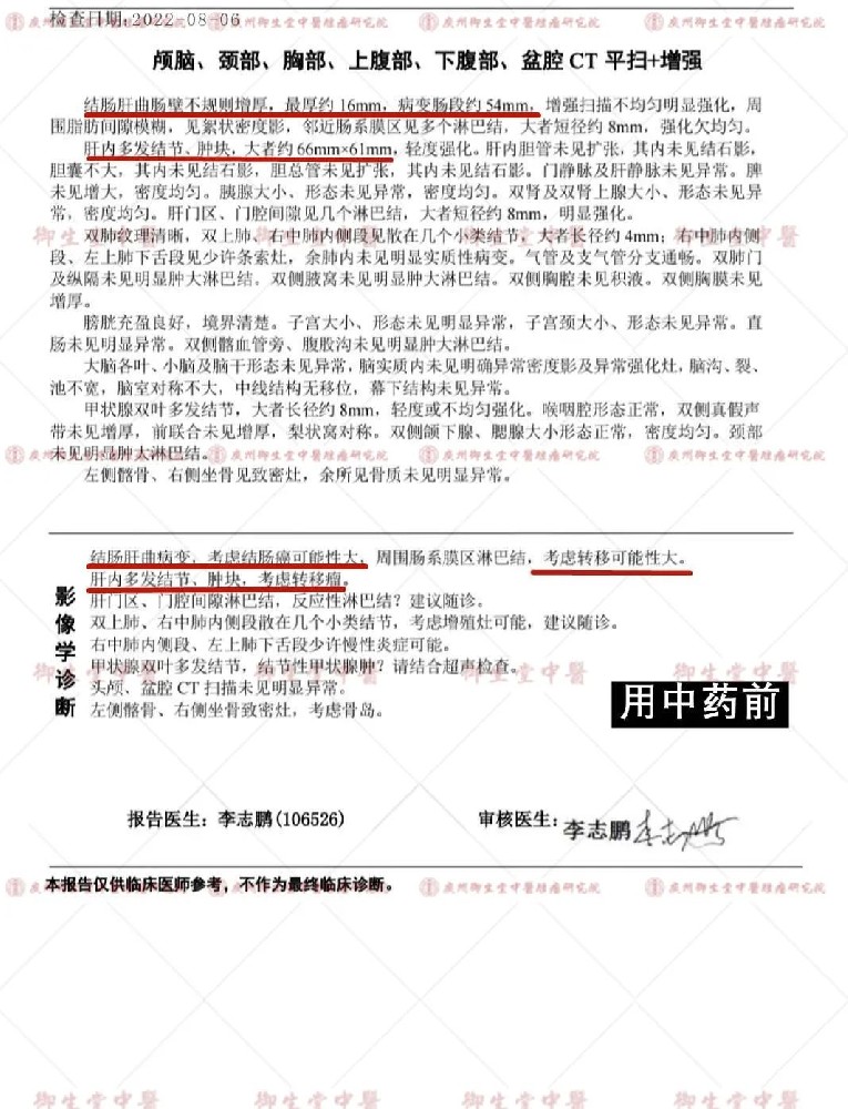 广州御和堂中医治疗肺癌晚期 症状消失继续抗转移治疗