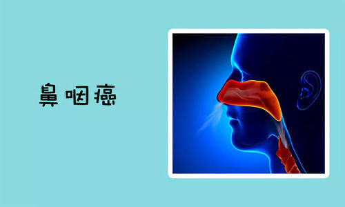鼻咽癌吃什么食物好？鼻咽癌患者的饮食禁忌
